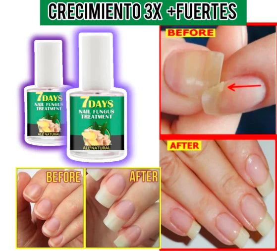 7 Days Nails Endurecedor De Unas 3